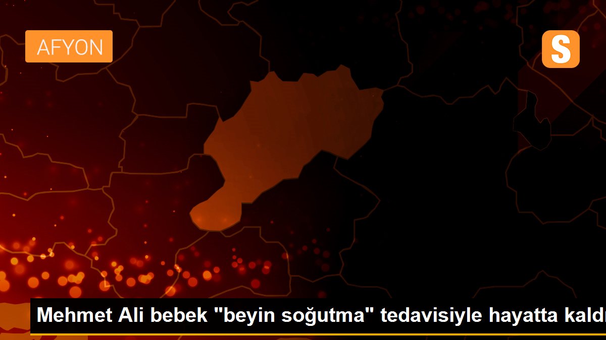 Mehmet Ali bebek "beyin soğutma" tedavisiyle hayatta kaldı