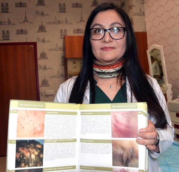 Prof Dr. Öztürk, 'Köpek memesi' hastalığına karşı uyardı