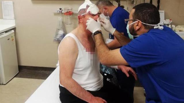 Selçuk Özdağ'a saldırı soruşturmasında, firari 3 kişiye yakalama kararı