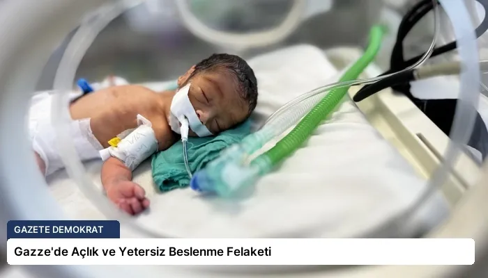 Gazze’de Açlık ve Yetersiz Beslenme Felaketi