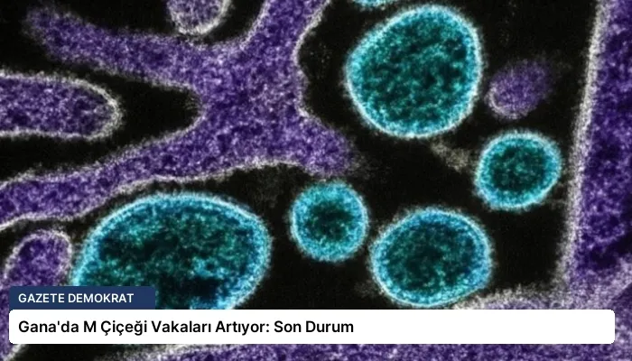 Gana’da M Çiçeği Vakaları Artıyor: Son Durum