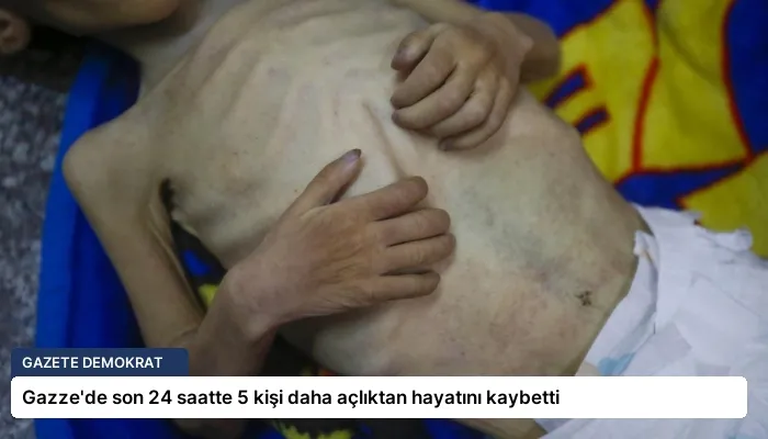 Gazze’de son 24 saatte 5 kişi daha açlıktan hayatını kaybetti