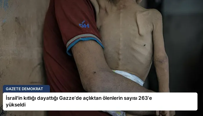 İsrail’in kıtlığı dayattığı Gazze’de açlıktan ölenlerin sayısı 263’e yükseldi