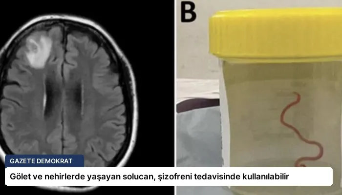 Gölet ve nehirlerde yaşayan solucan, şizofreni tedavisinde kullanılabilir