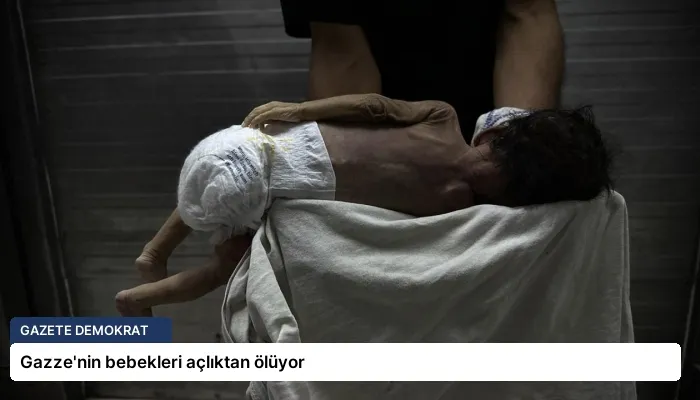Gazze’nin bebekleri açlıktan ölüyor