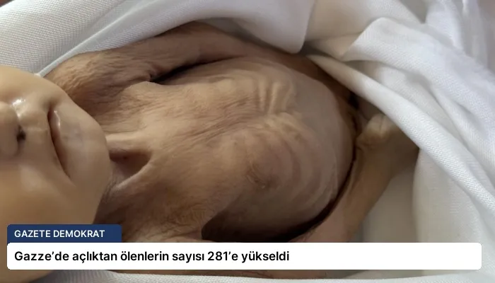 Gazze’de açlıktan ölenlerin sayısı 281’e yükseldi