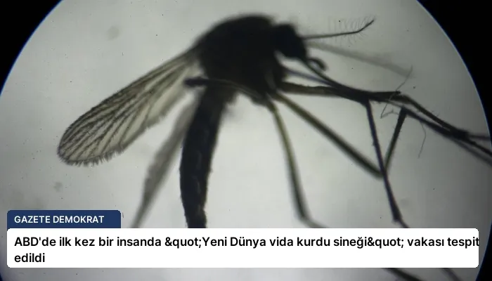 ABD’de ilk kez bir insanda "Yeni Dünya vida kurdu sineği" vakası tespit edildi