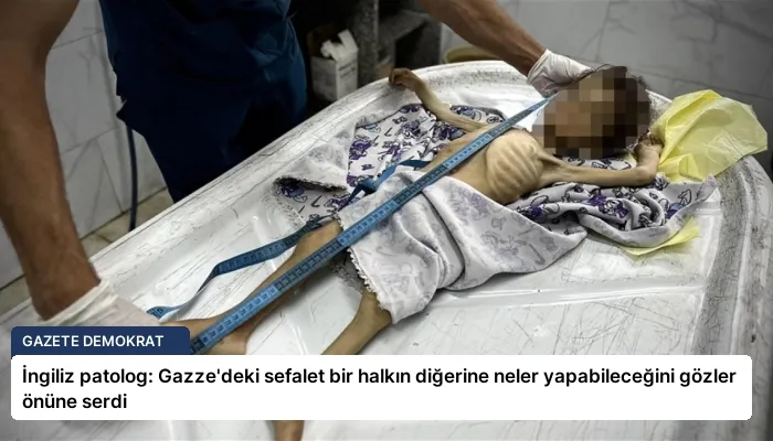 İngiliz patolog: Gazze’deki sefalet bir halkın diğerine neler yapabileceğini gözler önüne serdi