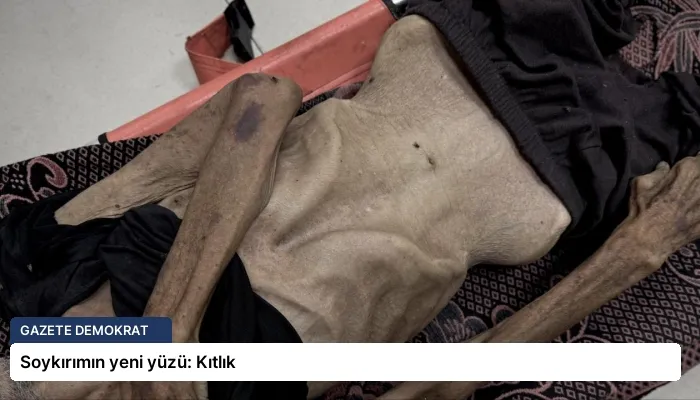 Soykırımın yeni yüzü: Kıtlık