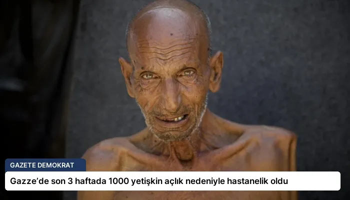 Gazze’de son 3 haftada 1000 yetişkin açlık nedeniyle hastanelik oldu