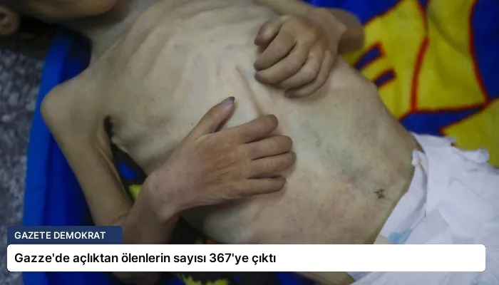 Gazze’de açlıktan ölenlerin sayısı 367’ye çıktı