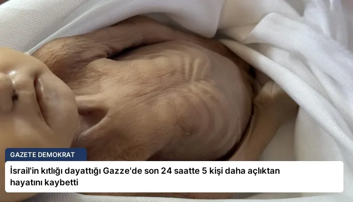 İsrail’in kıtlığı dayattığı Gazze’de son 24 saatte 5 kişi daha açlıktan hayatını kaybetti