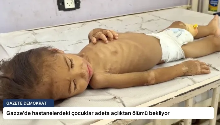 Gazze’de hastanelerdeki çocuklar adeta açlıktan ölümü bekliyor