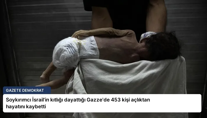Soykırımcı İsrail’in kıtlığı dayattığı Gazze’de 453 kişi açlıktan hayatını kaybetti