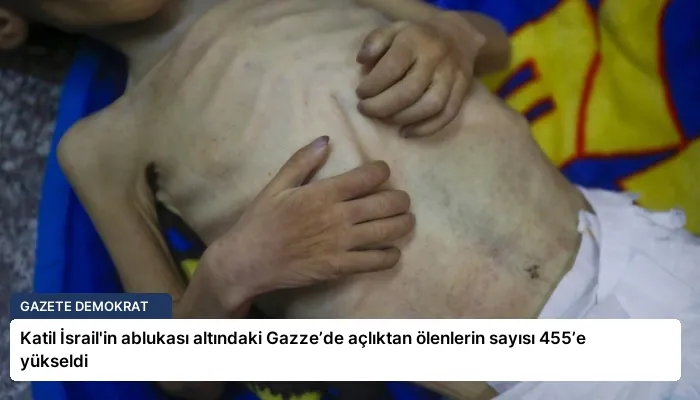 Katil İsrail’in ablukası altındaki Gazze’de açlıktan ölenlerin sayısı 455’e yükseldi