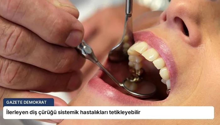 İlerleyen diş çürüğü sistemik hastalıkları tetikleyebilir