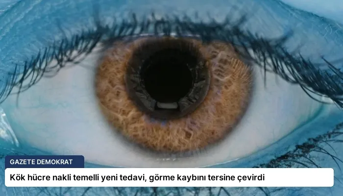Kök hücre nakli temelli yeni tedavi, görme kaybını tersine çevirdi