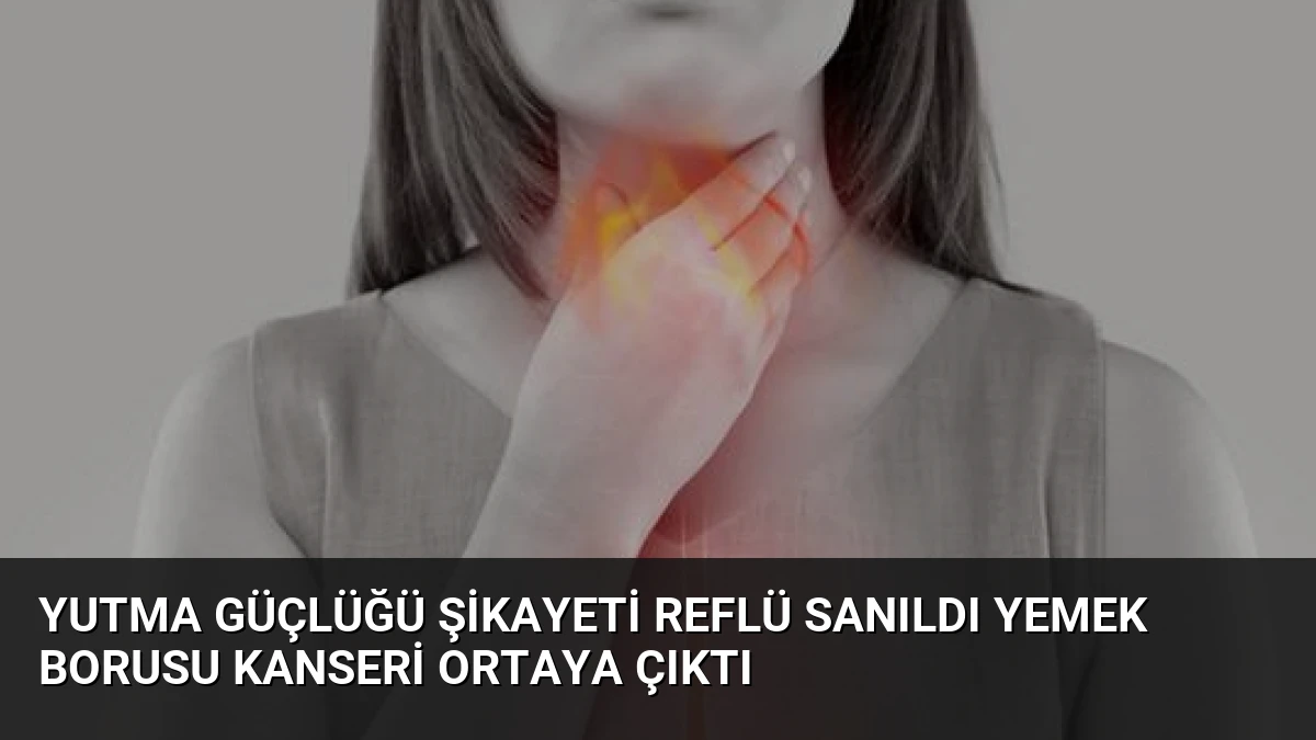 Yutma Güçlüğü Şikayeti Reflü Sanıldı Yemek Borusu Kanseri Ortaya Çıktı