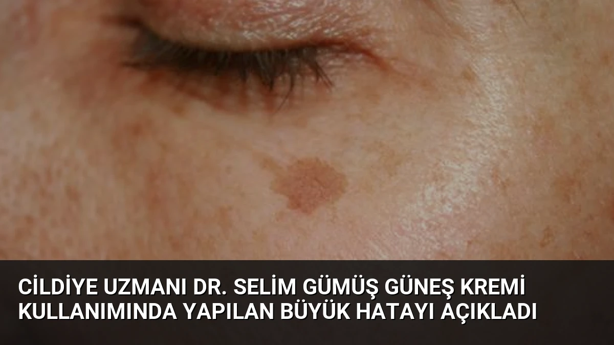 Cildiye Uzmanı Dr. Selim Gümüş Güneş Kremi Kullanımında Yapılan Büyük Hatayı Açıkladı