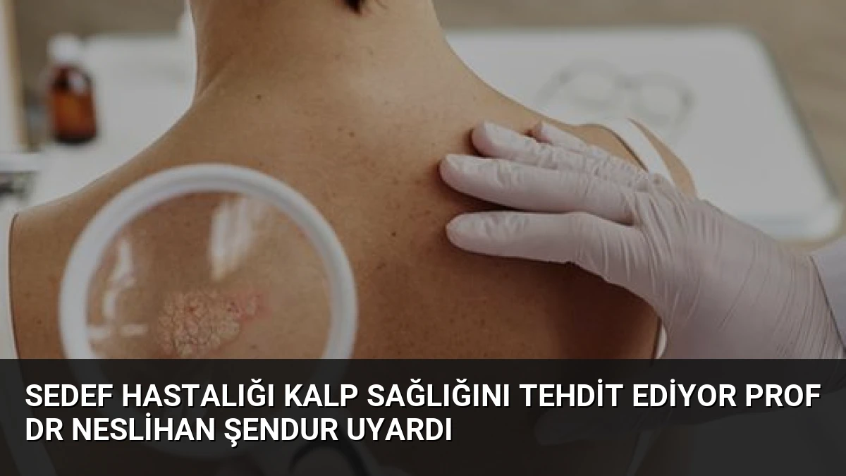 Sedef Hastalığı Kalp Sağlığını Tehdit Ediyor Prof Dr Neslihan Şendur Uyardı